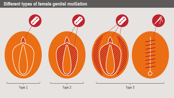 Женское обрезание: как жестокие традиции ломают жизнь