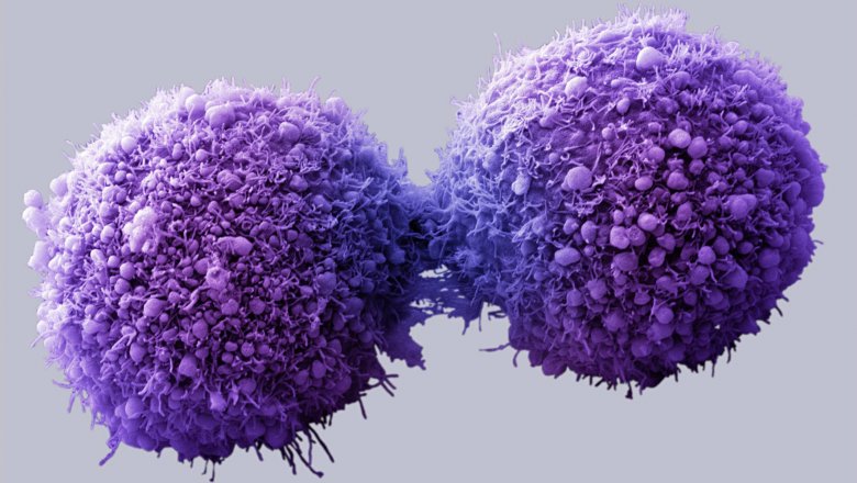 Для формирования опухоли необходимо менее 5% раковых клеток.