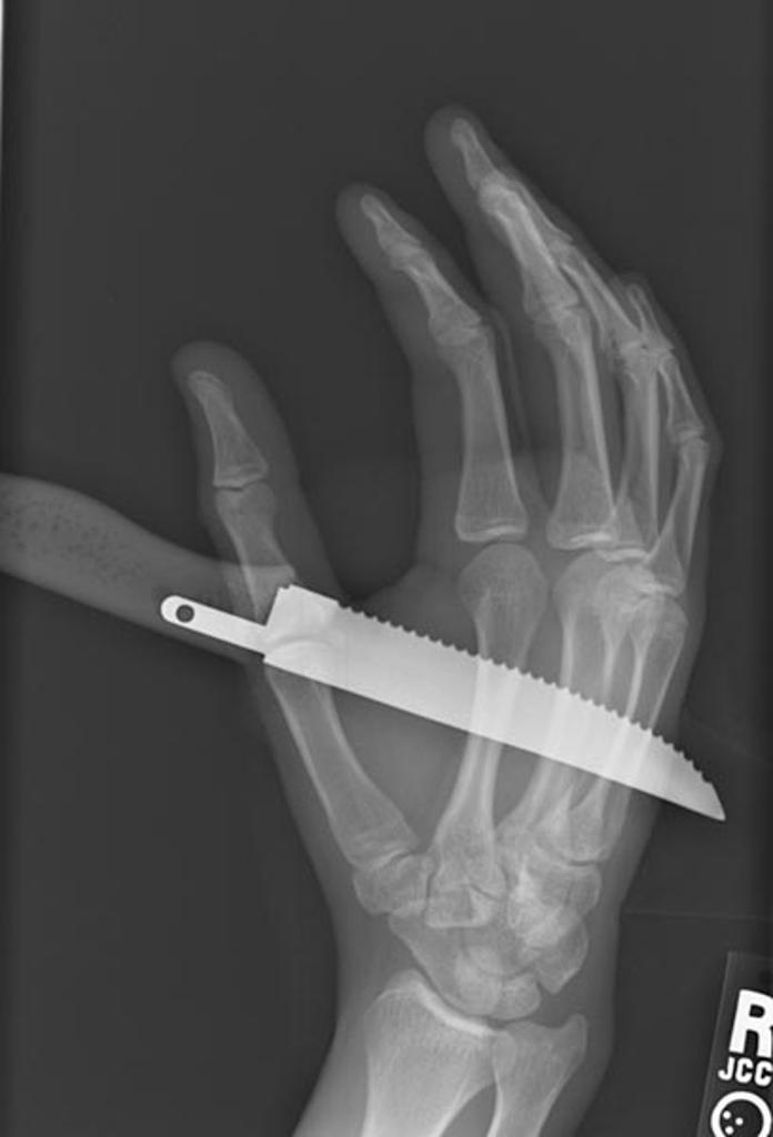 Нож в руке