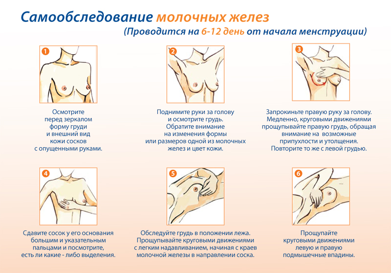 Рак молочной железы: как предотвратить, выявить и где лечить в Киеве