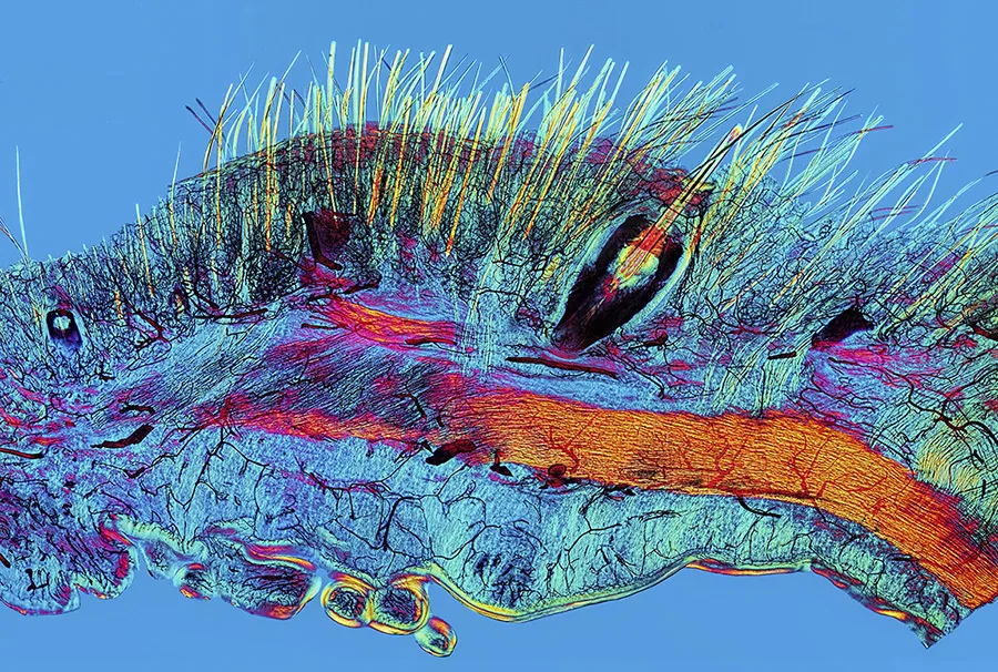 То, что внутри нас: 12 снимков победителей фотоконкурса биомедицины Wellcome Image