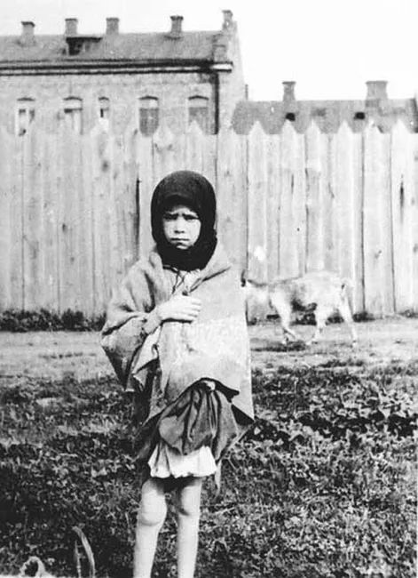 Дівчинка – жертва голоду. Харків, 1933 р. Фото з Колекції Кардинала Теодора Інніцира (Архів Віденської Дієцезії). Фото зробив інж. А. Вінербергер. Фотодокументи надані проф. Василем Марочком (Інститут історії України НАН України). – ЦДКФФА України імені Г. С. Пшеничного. Од.зб.5120.