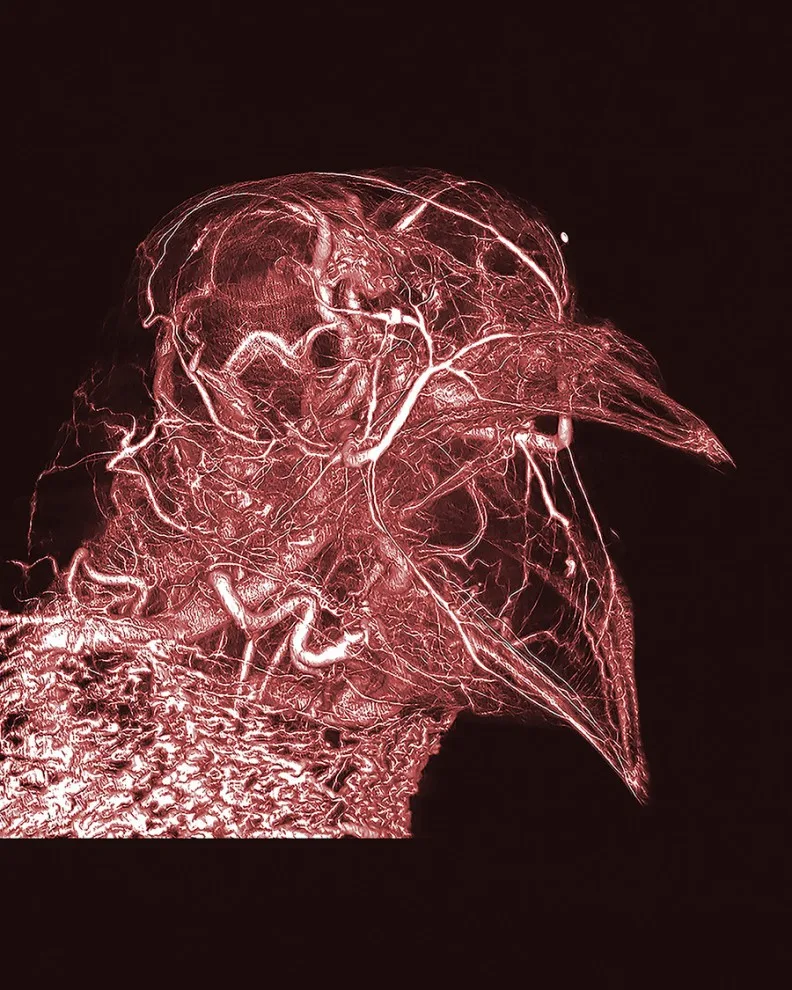 То, что внутри нас: 12 снимков победителей фотоконкурса биомедицины Wellcome Image